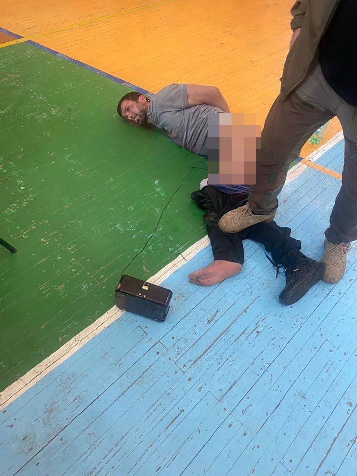 A grim photo shows the suspect with wires connected to his groin and his mouth foaming as he grits his teeth in pain