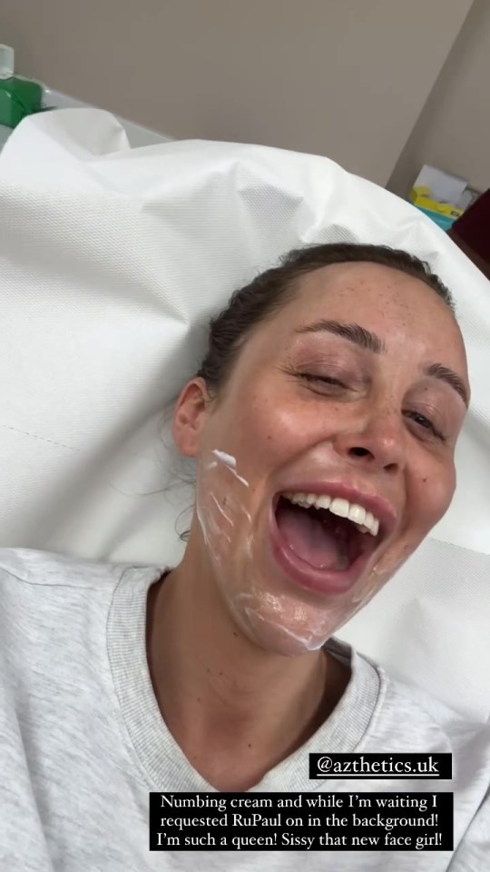 Ella has been getting her fillers dissolved