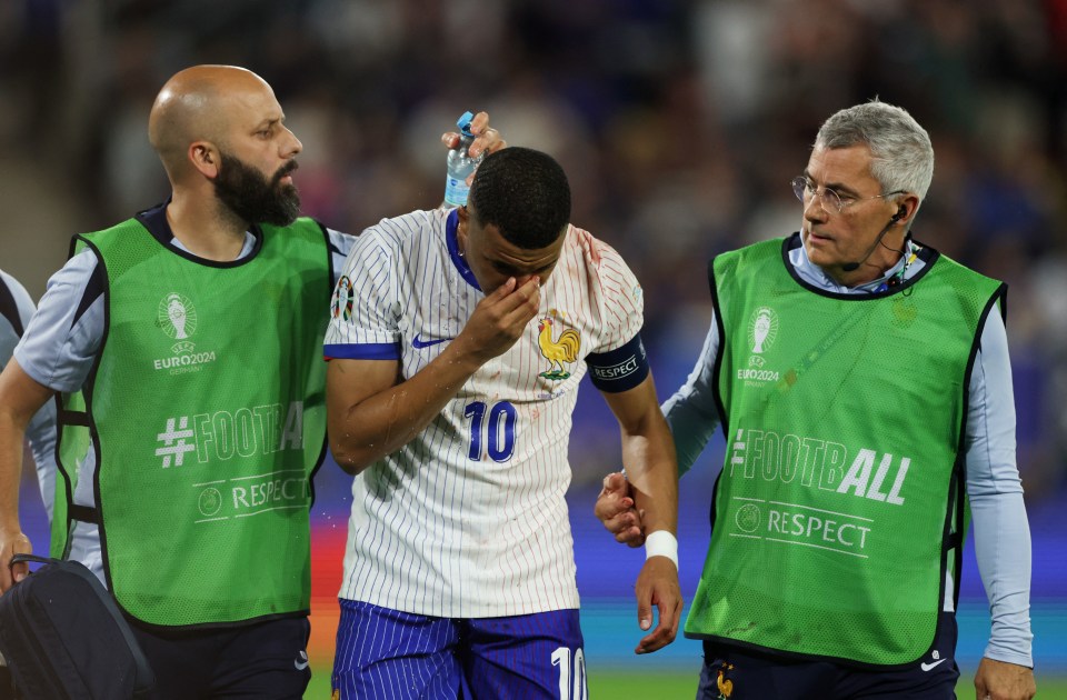 Soccer Football - Euro 2024 - Group D - Austria v France - Dusseldorf Arena, Dusseldorf, Germany - June 17, 2024 France's Kylian Mbappe receives medical attention after sustaining an injury REUTERS/Thilo Schmuelgen