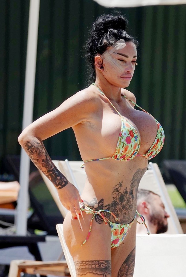  Katie Price at the pool with her heavily bruised face this week after having her sixth £10,000 facelift in Turkey (Backgrid)