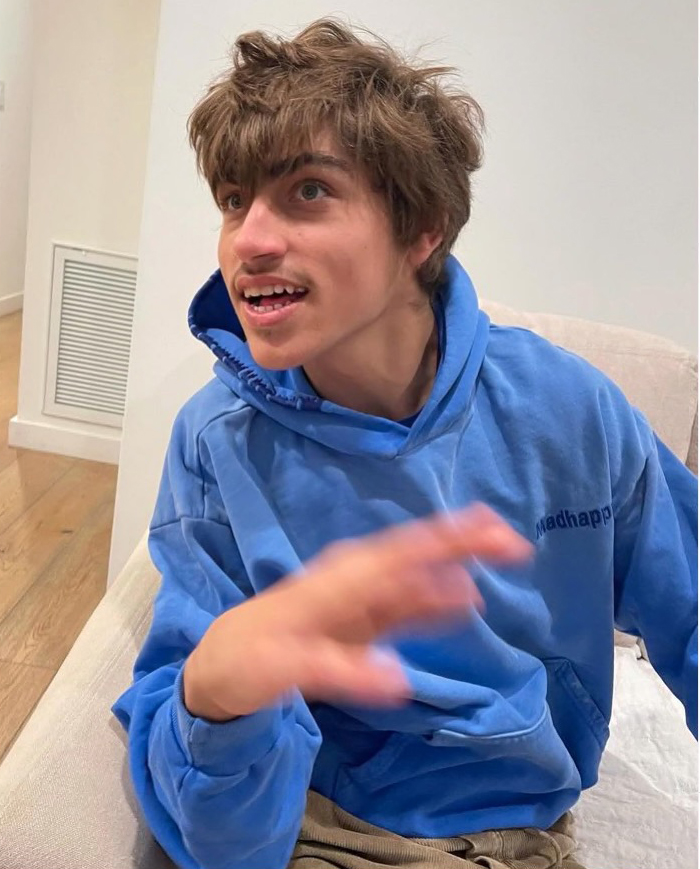 The 20-year-old was born with Angelman syndrome