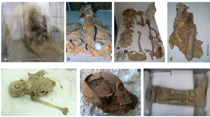 a collage of photos of various bones including a skull and a leather shoe with lower leg
