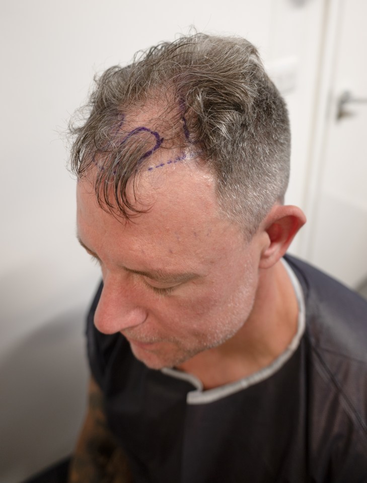 a man with a drawing of a heart on his head