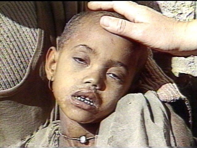 a close up of a child 's face with a person 's hand on it .
