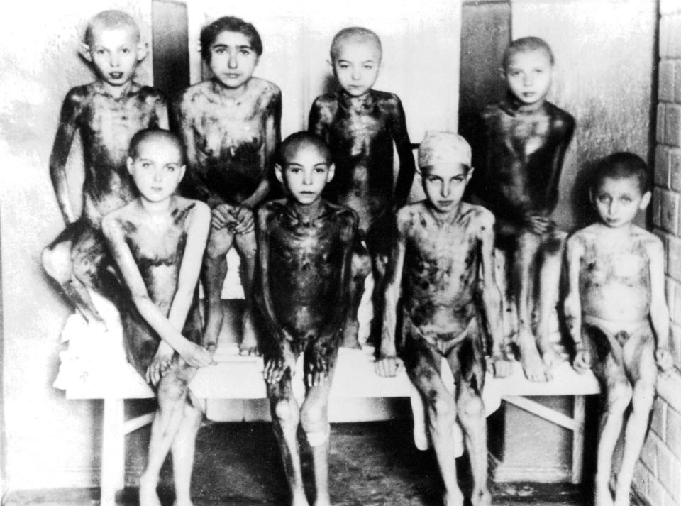 Emaciated Jewish children, victims of Nazi medical experimentation at Auschwitz.