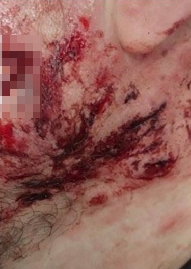 A man was left with serious facial injuries after a dog attack - pictured here by local police