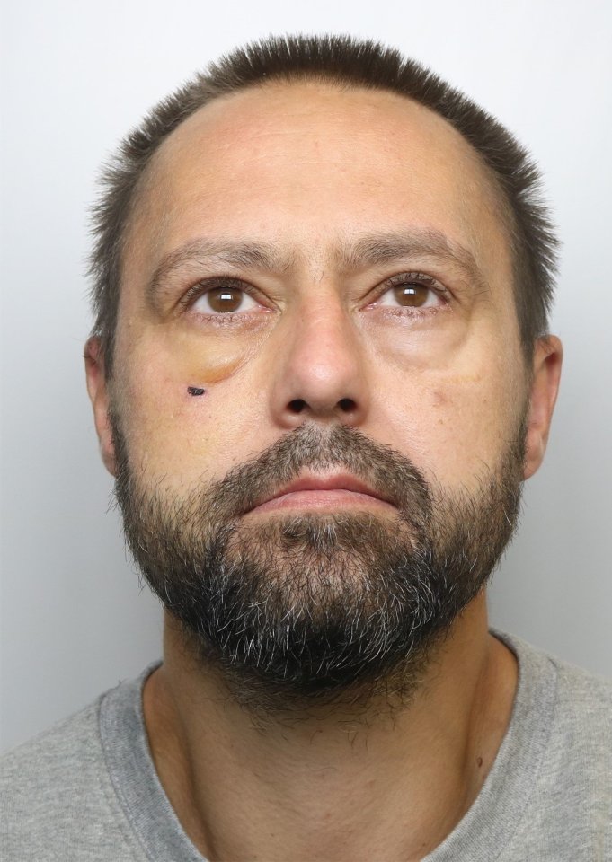 a man with a beard has a black spot on his face