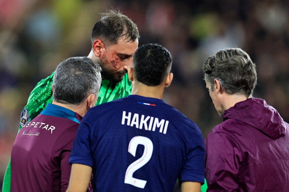 Injured soccer goalkeeper receiving medical attention.