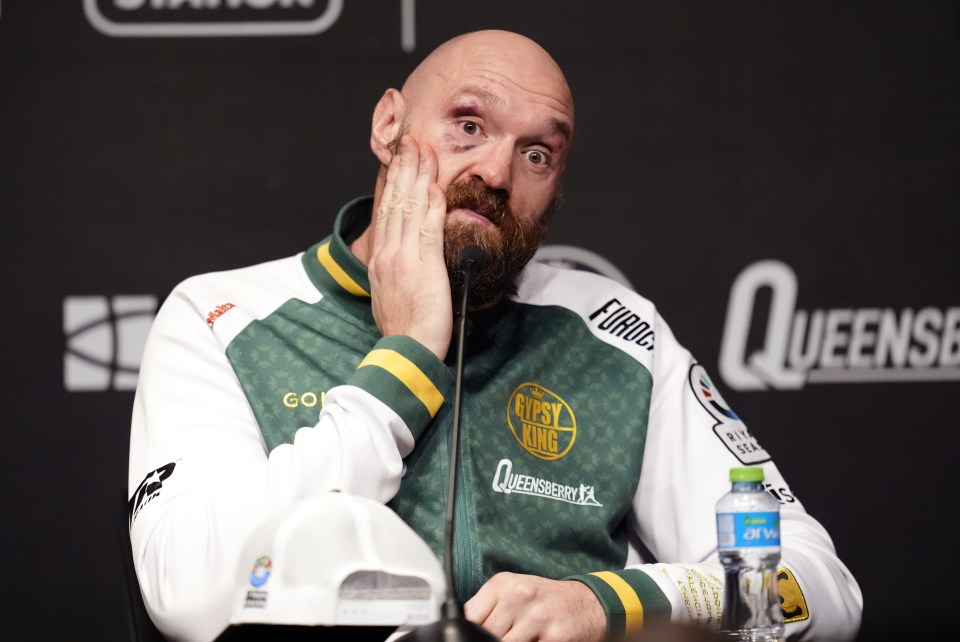 Tyson Fury at a press conference, appearing upset.