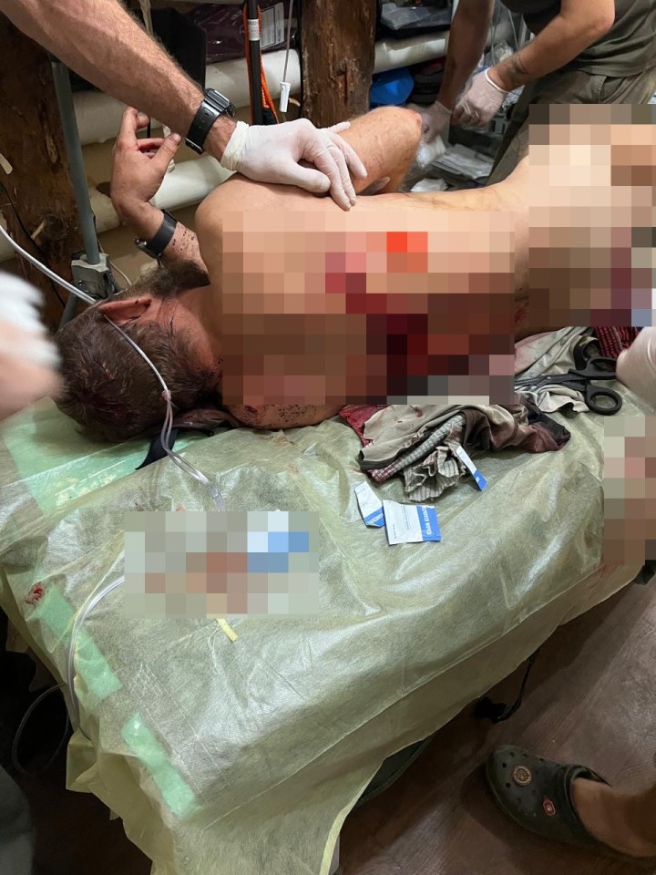 Graphic image of a wounded man receiving medical attention.