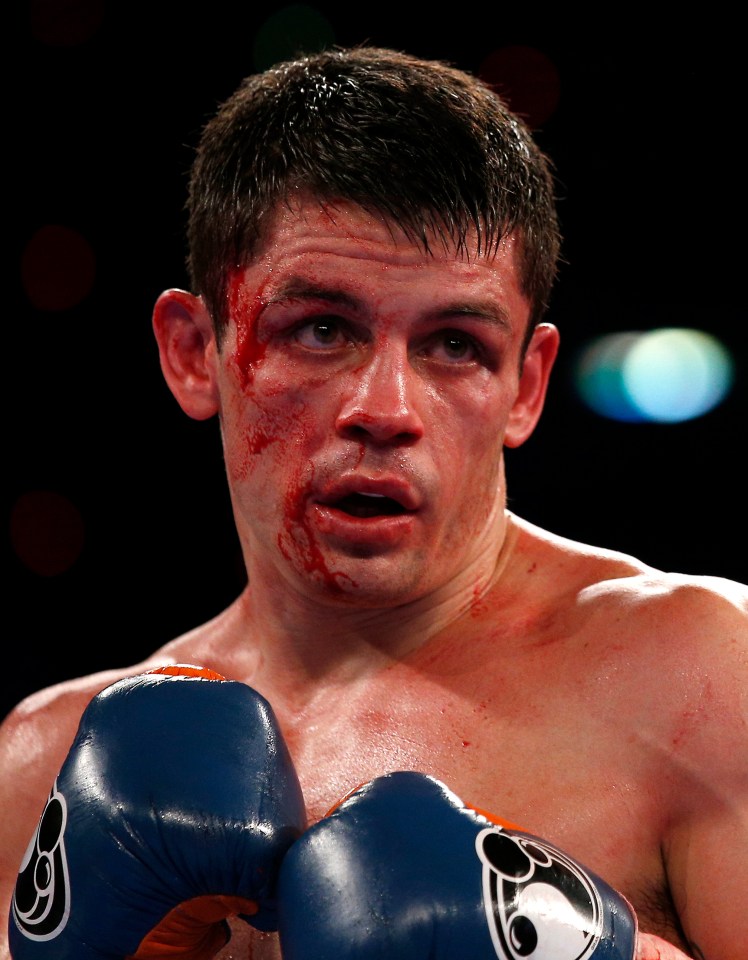 A bloody boxer in boxing gloves.