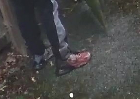 Bloodstained shoes at a crime scene.