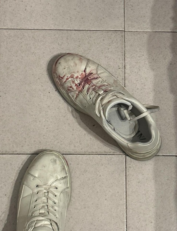 Blood-stained white sneaker on a tiled floor.