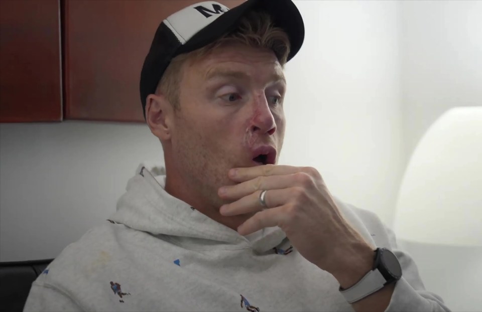 Freddie Flintoff looking surprised.
