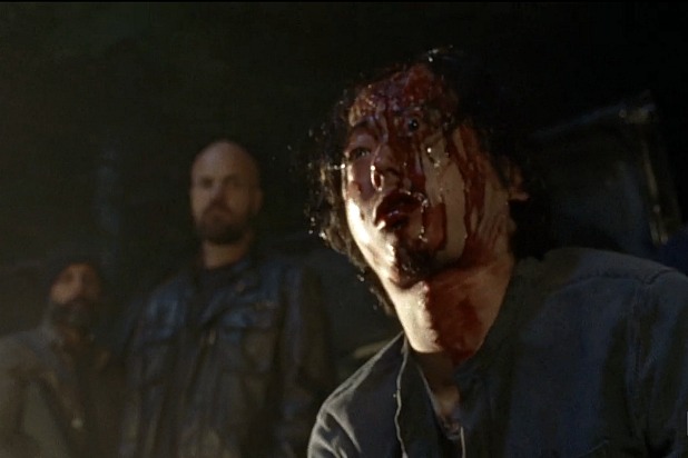 A bloody, injured man surrounded by other people.