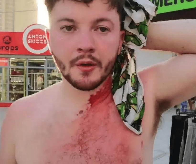 A man with bloody injuries to his head and neck.