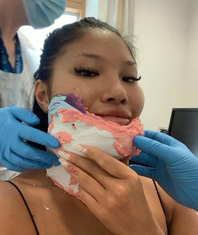 Woman having a facial mold applied.