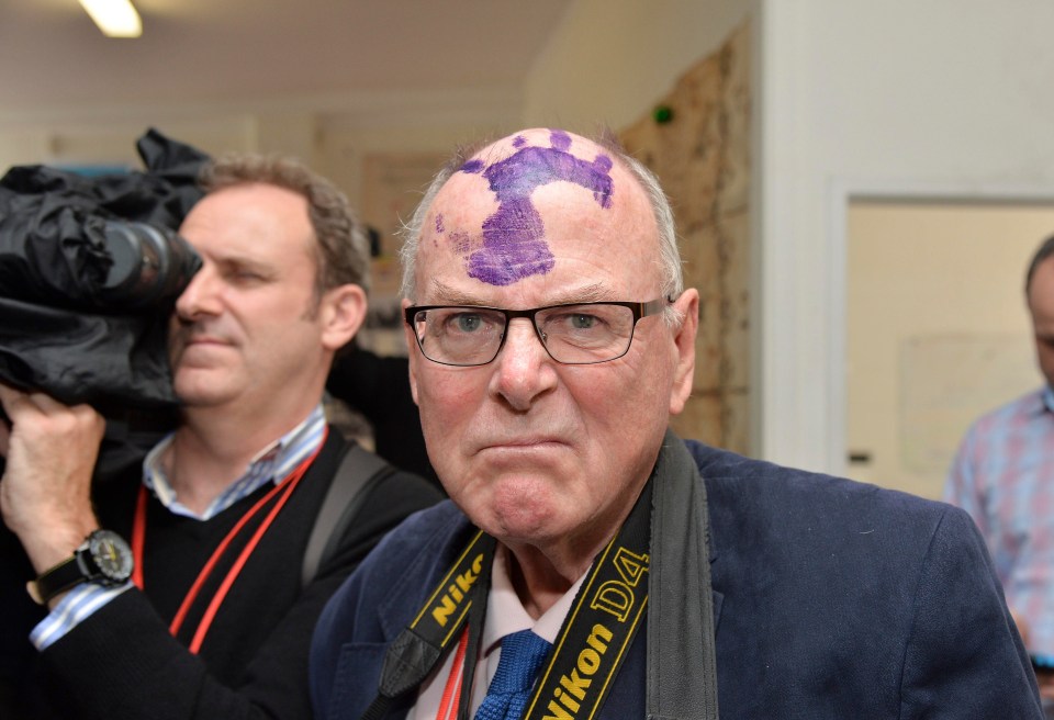 Man with purple handprint on forehead.
