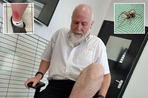 An image collage containing 3 images, Image 1 shows Man with swollen ankle after spider bite, Image 2 shows Spider bite on a person's ankle, Image 3 shows Noble false widow spider on green fabric
