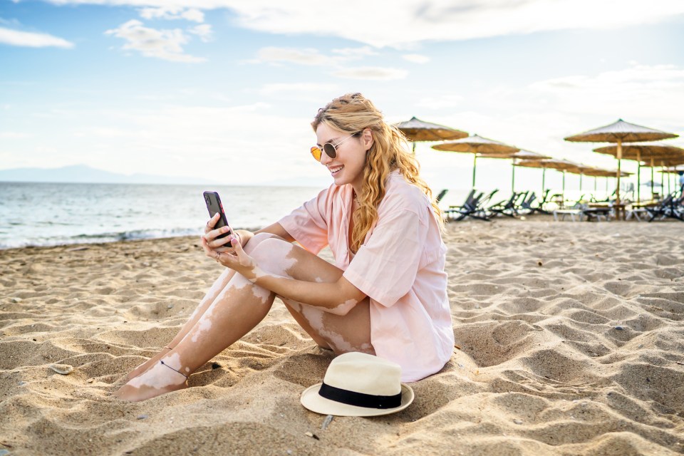Smiling young woman with vitiligo is using her smartphone while sitting on the sand at the beach