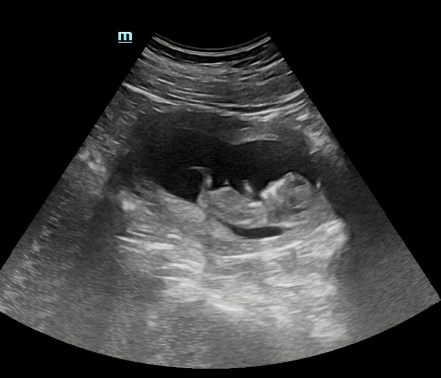 Ultrasound image of a fetus.