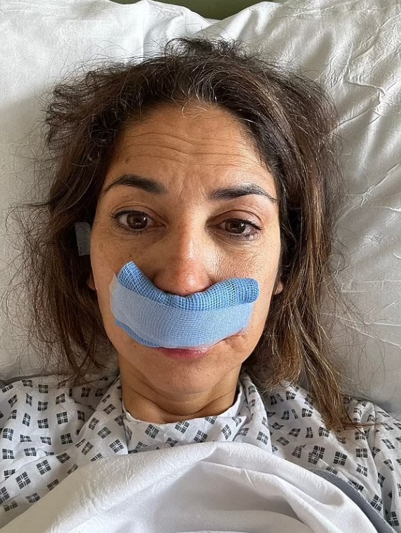 Woman in hospital gown with a bandage over her upper lip.