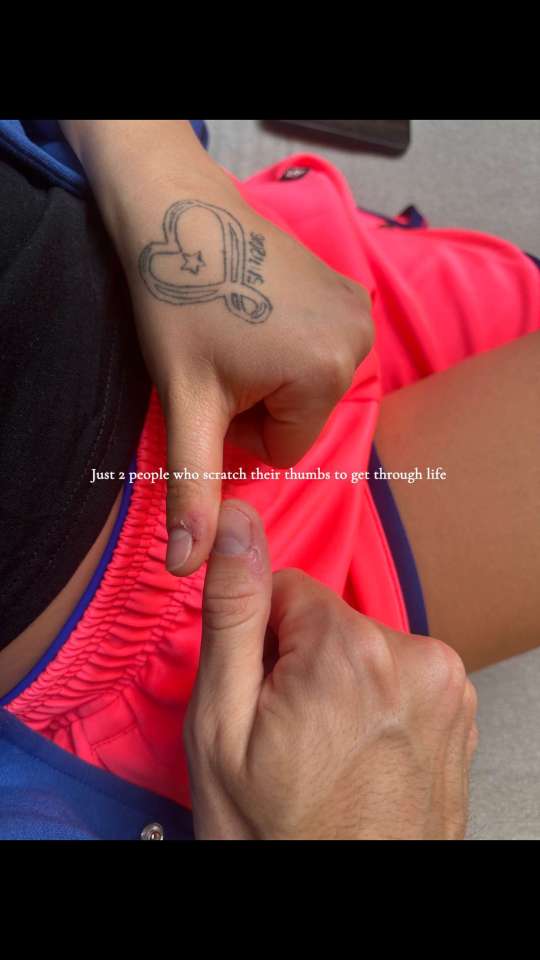 Two people scratching their thumbs.